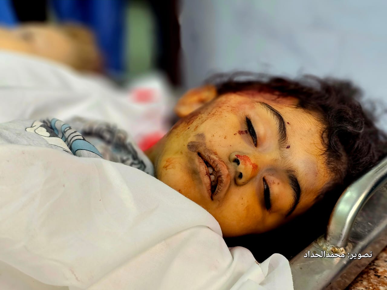 عدوان إسر..ائيل على غ..زة : حرب بلا بطولة 1 عدوان إسر..ائيل على غ..زة : حرب بلا بطولة