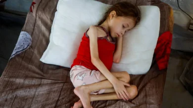 حصيلة ضحايا المجاعة في غزة ترتفع إلى 376 شهيدًا بينهم 134 طفلًا