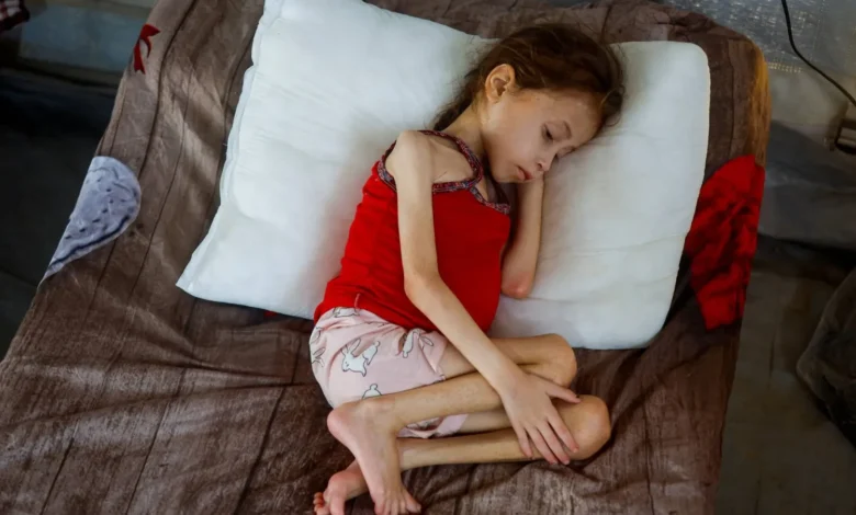 حصيلة ضحايا المجاعة في غزة ترتفع إلى 376 شهيدًا بينهم 134 طفلًا 1 حصيلة ضحايا المجاعة في غزة ترتفع إلى 376 شهيدًا بينهم 134 طفلًا
