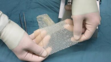 أستاذ جلدية: التبرع بجلد الإنسان بعد الوفاة غير ممكن طبيًا