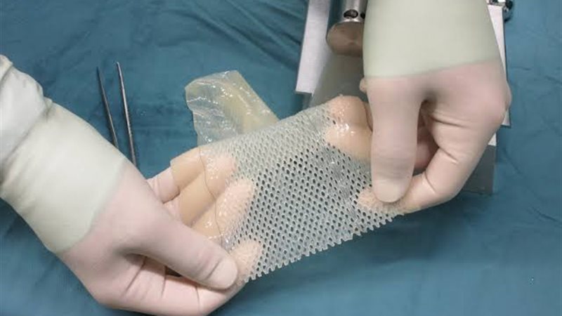 أستاذ جلدية: التبرع بجلد الإنسان بعد الوفاة غير ممكن طبيًا