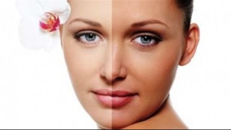 نصائح فعالة لحماية البشرة من الاسمرار والتصبغات خلال فصل الصيف